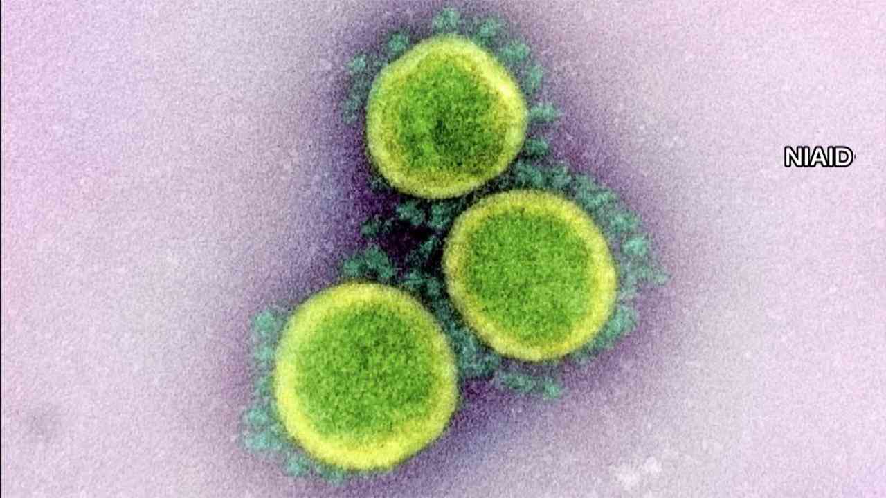 新型コロナ 全国の重症者数は596人 4日連続で500人超え(FNNプライムオンライン) - Yahoo!ニュース