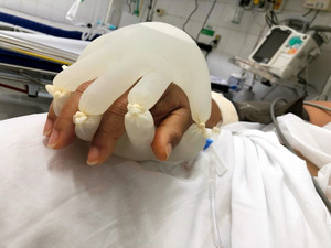 コロナ患者の手握る「神の手」　ブラジル発のケアに注目
