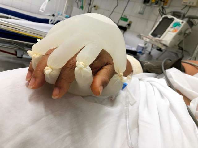 コロナ患者の手握る「神の手」　ブラジル発のケアに注目（朝日新聞デジタル） - Yahoo!ニュース