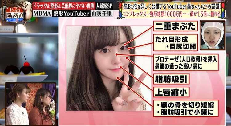美容整形の怖い話Part2