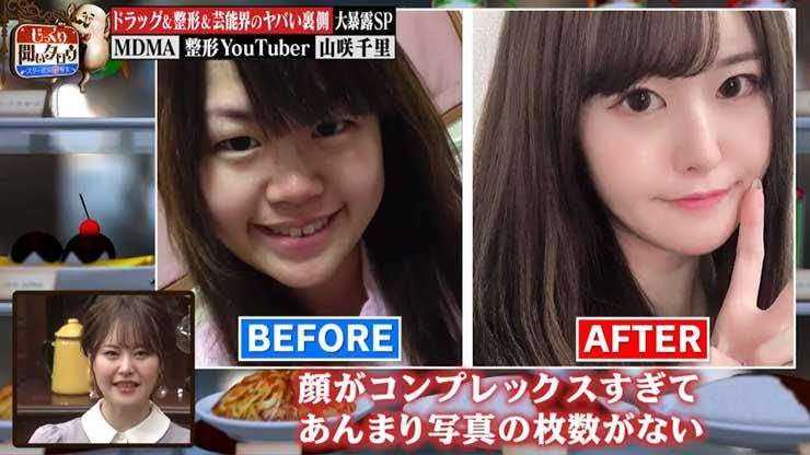 美容整形の怖い話Part2