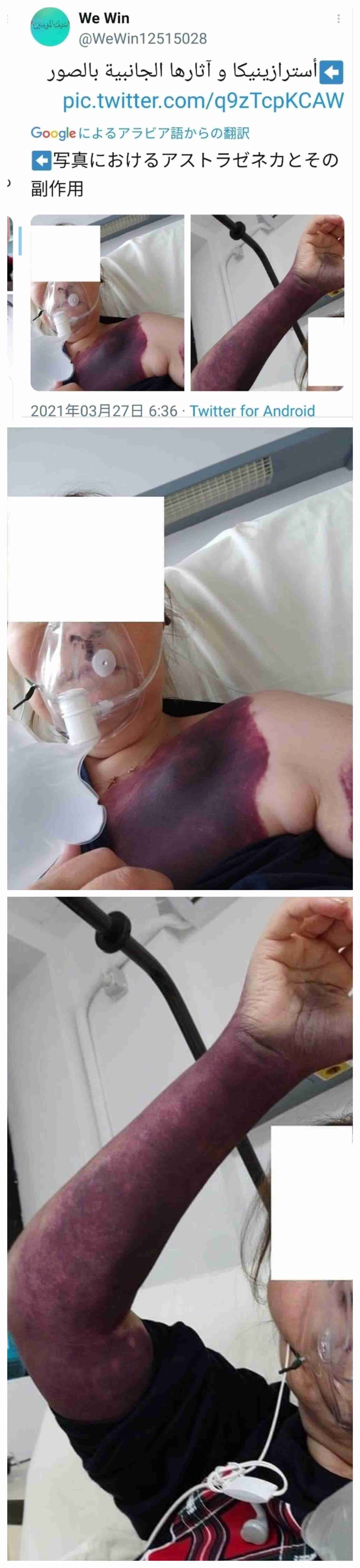 医療従事者のみなさん、ワクチン受けましたか？
