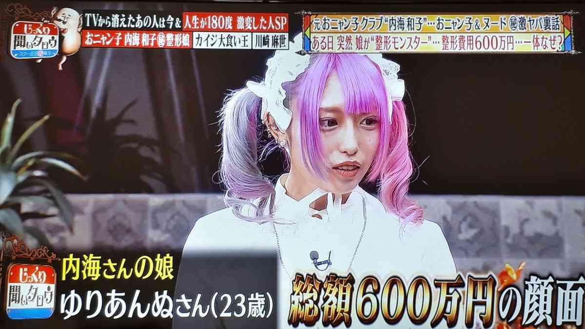 整形総額800万円の地下アイドル　鼻に指入らず「鼻炎でつらい」　元おニャン子の母「娘と何度も戦った」