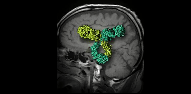 血液脳関門を突破するテクノロジーが開発され、次世代ワクチンが経口となる可能性 - 昴のオルタナティブチャンネル