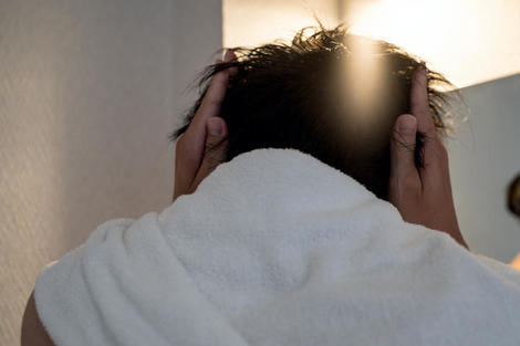 「アジア人は禿げない」神話に異変　東アジアで薄毛化加速、中国では20年早まる | ワールド | 最新記事 | ニューズウィーク日本版 オフィシャルサイト