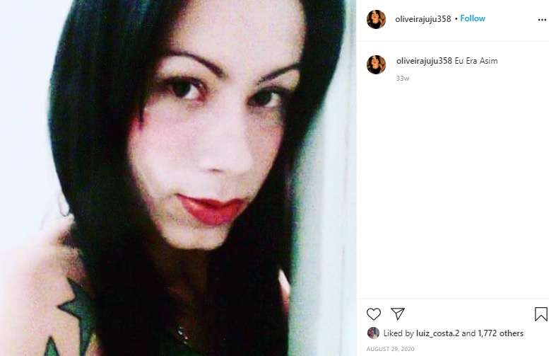 【閲覧注意？】顔に工業用シリコンを注入したトランスジェンダーの女性「頬が垂れて戻らないの」（ブラジル）