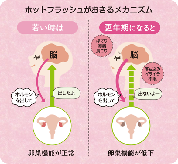 ホットフラッシュ対策教えて下さい‼︎