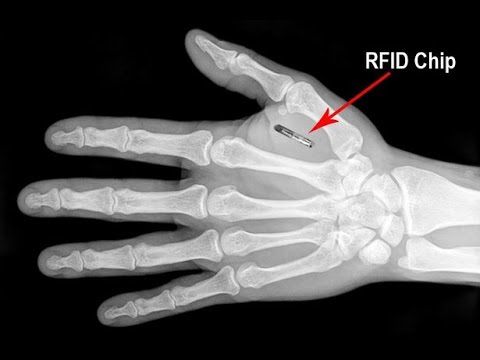 Twitter、「クラブハウス」買収で一時交渉　米報道