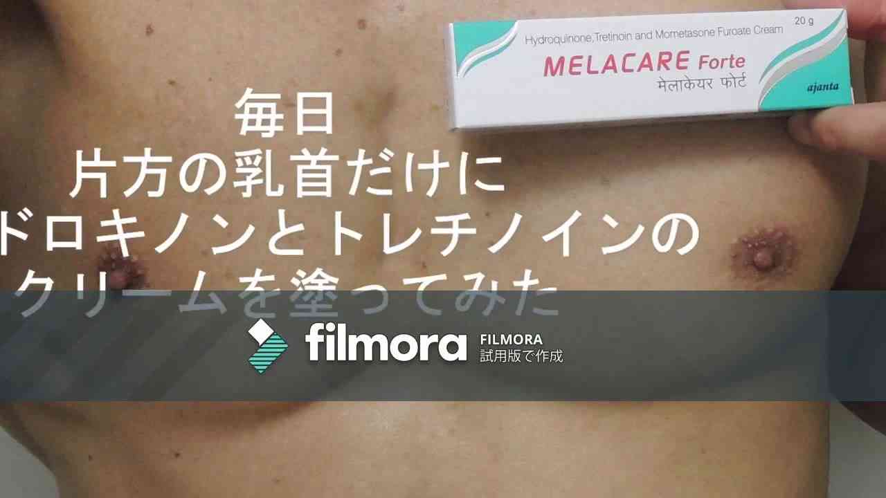 目指せピンク 片方の乳首だけにハイドロキノンとトレチノインのクリームを塗ってみた - YouTube