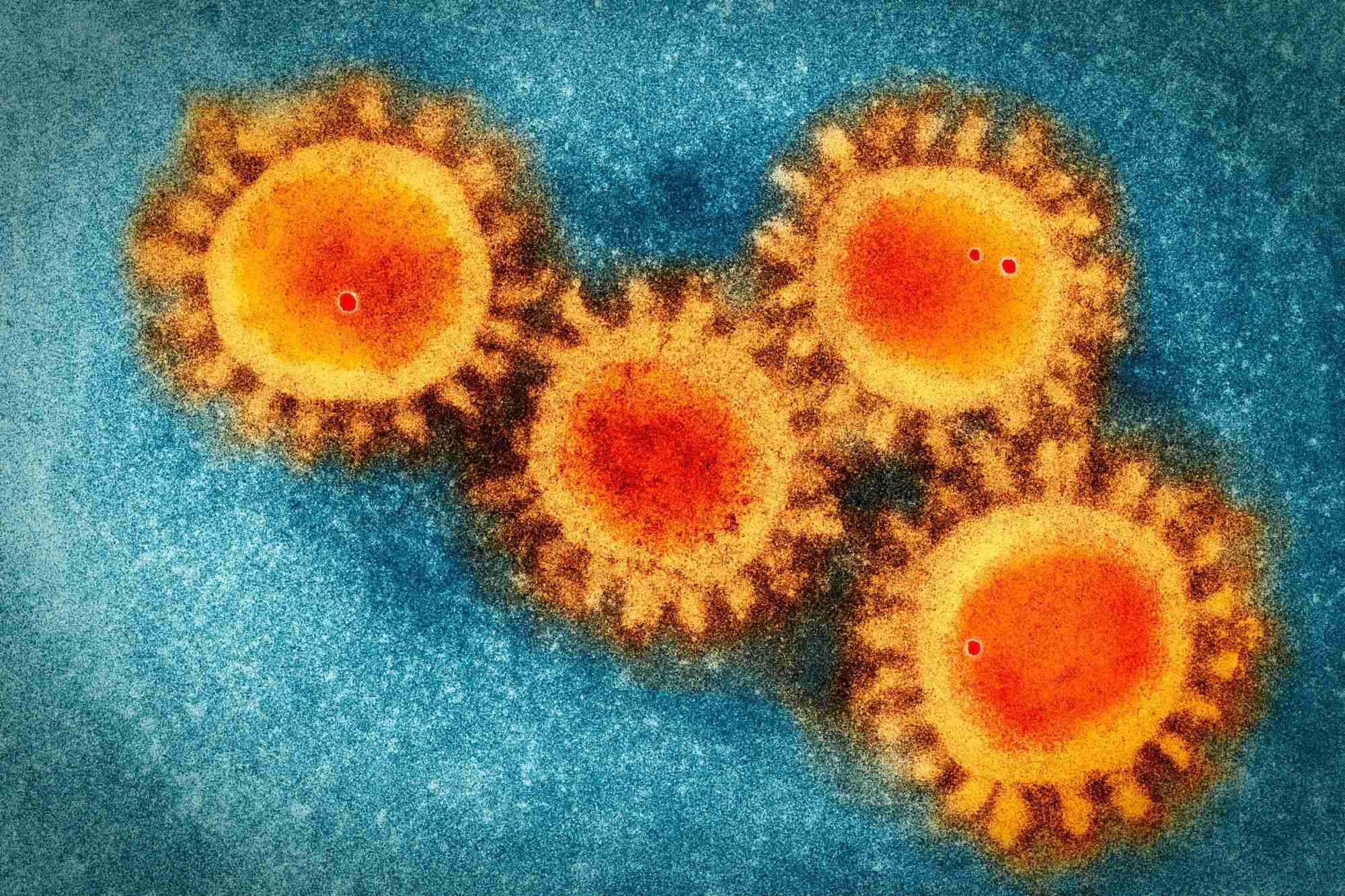 動物実験で、どこまで新型コロナウイルス感染症の症状を“再現”できるか：研究者たちの挑戦と課題 | WIRED.jp