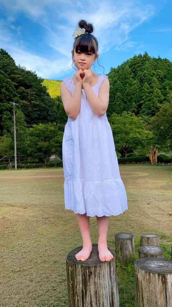 ダウン症モデル・菜桜さんが「かわいい」と話題！　15回の手術を乗り越えて母子が抱く夢