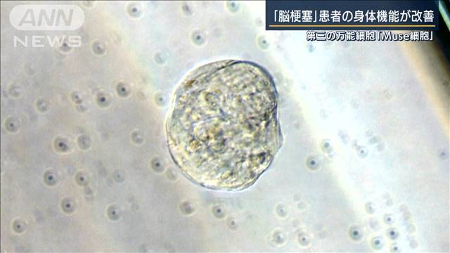 “Muse細胞”脳梗塞患者の身体機能が改善（テレビ朝日系（ANN）） - Yahoo!ニュース