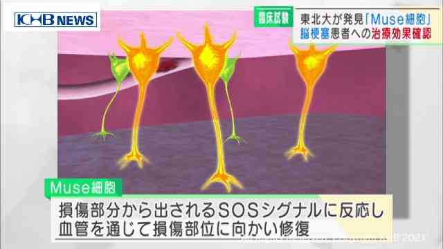 脳梗塞患者に治療効果　新型コロナの呼吸不全やALSの治療にも期待　東北大学が発見「Muse細胞」（KHB東日本放送） - Yahoo!ニュース