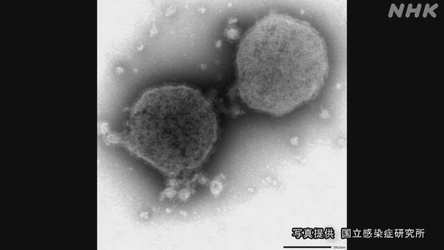 “子どもが感染”RSウイルス感染症患者 急増 コロナ対策影響か | 医療 | NHKニュース