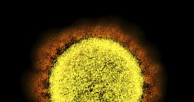 感染促す“悪玉”増強抗体発見　新型コロナで大阪大