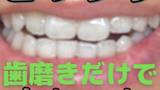 2021年6月8日  |  バラエティーブログ