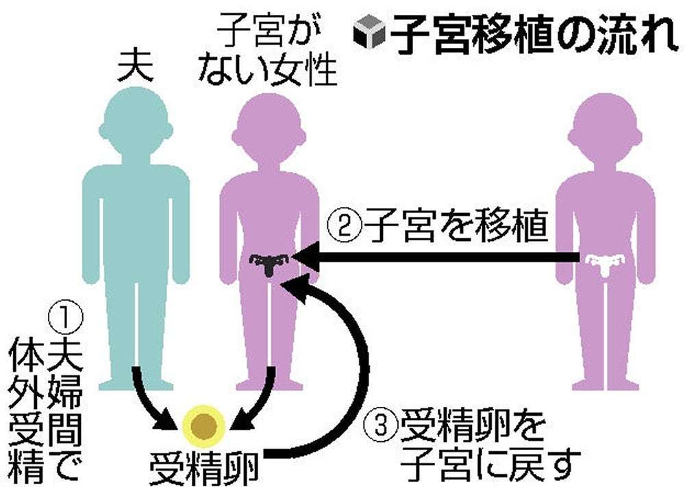 子宮移植、臨床研究を容認へ…「自発的」「無償提供」など条件に