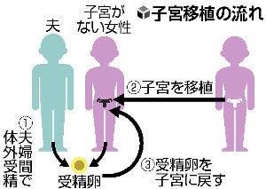 【独自】子宮移植、臨床研究を容認へ…「自発的」「無償提供」など条件に : 医療・健康 : ニュース : 読売新聞オンライン
