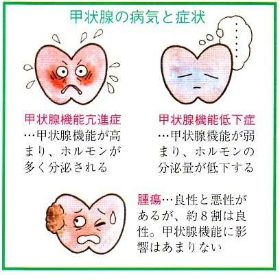 甲状腺病気の方　part2
