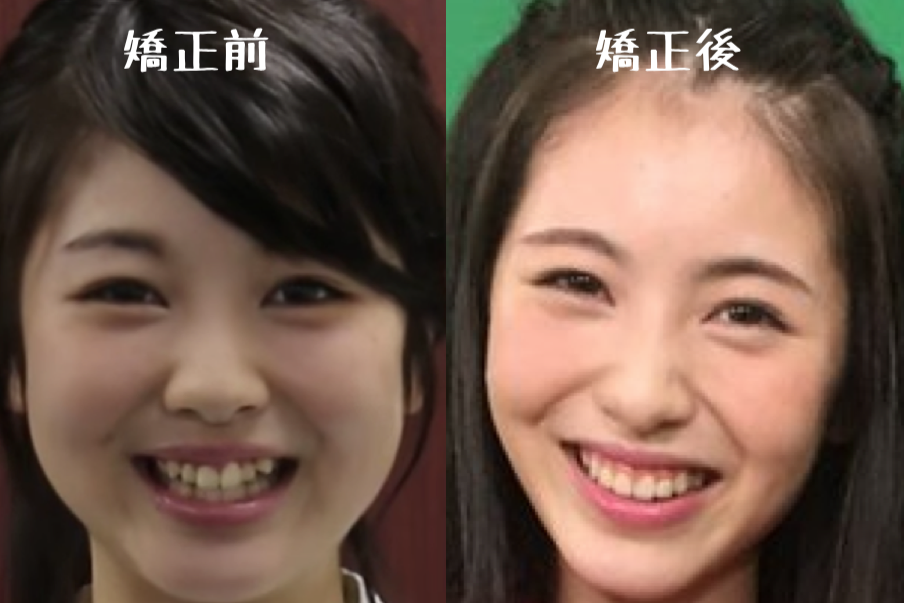 日テレ系ドラマ「ハコヅメ」オフィシャルブログ開設 W主演・戸田恵梨香&永野芽郁のオフショットも公開