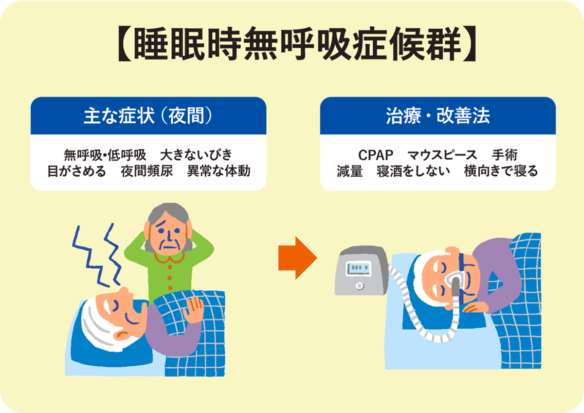 ナルコレプシーと睡眠時無呼吸症候群の両方を患うことはありますか?
