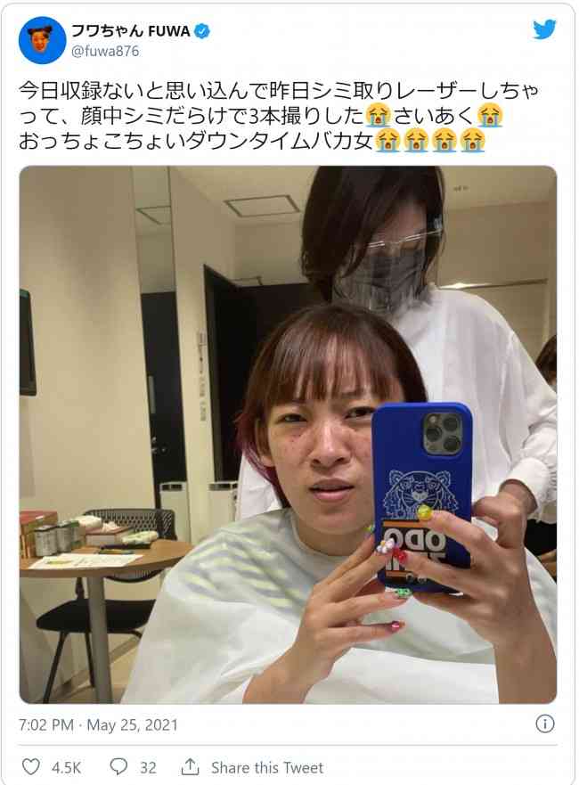 シミ取りレーザーについて語ろう！