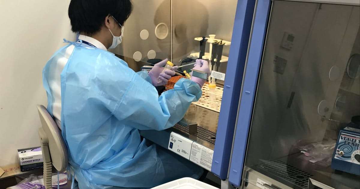 新型コロナ: PCR「陽性」基準値巡り議論、日本は厳しめ？: 日本経済新聞