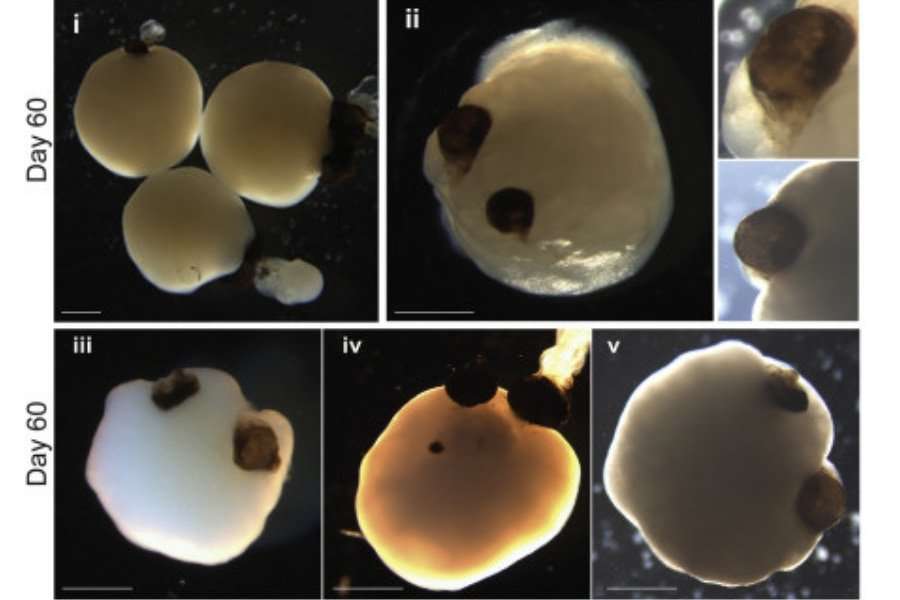 「目がある人工脳」を作り出すことに成功、視神経もあり光を検知 - ナゾロジー