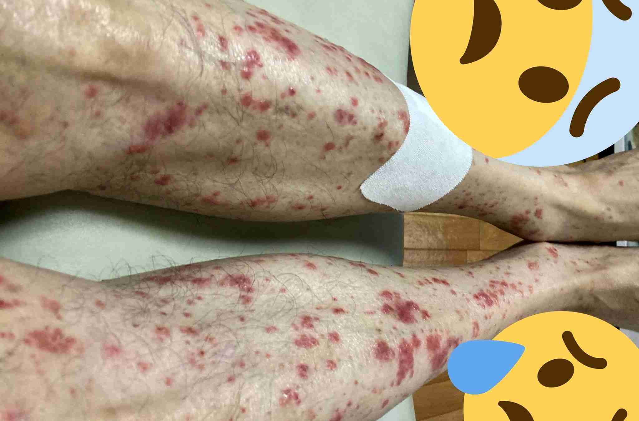 報告は氷山の一角！コロナワクチン接種後の副反応、死亡のツイートが多すぎて戦慄！vol.50 | 泣いて生まれてきたけれど