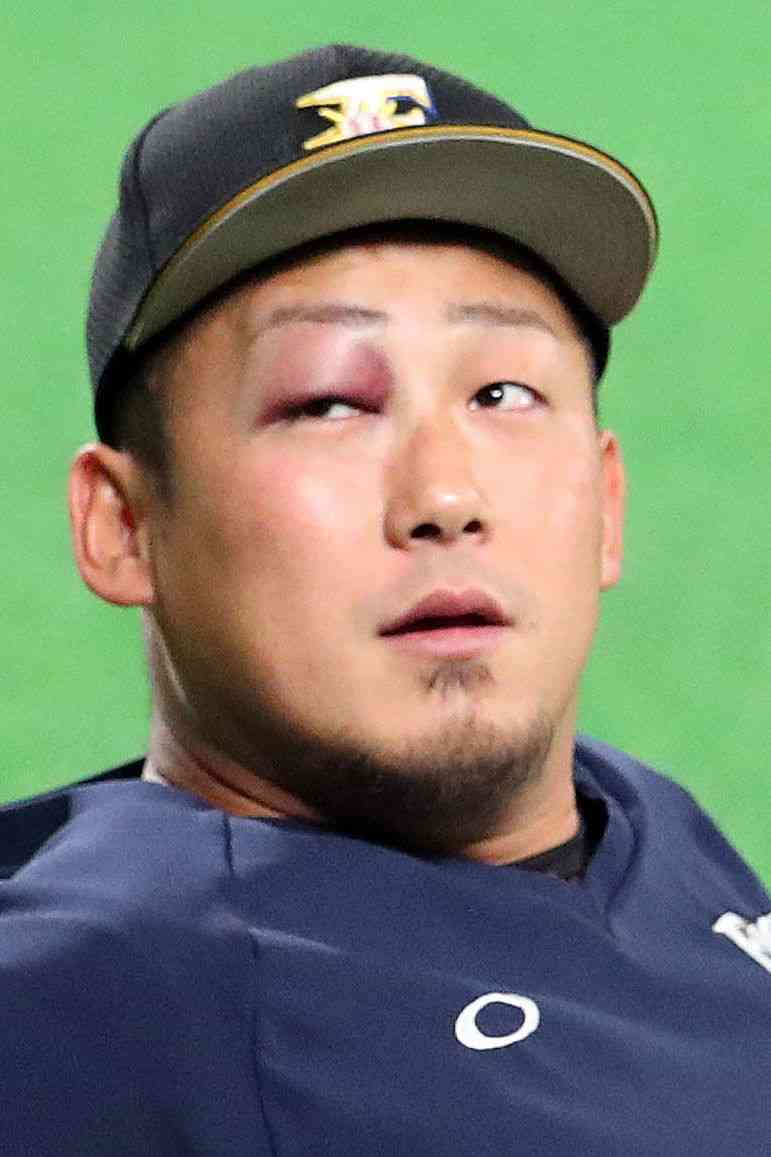 日ハム「中田翔」暴行事件の被害者は「27歳中堅投手」　後輩イジりが原因か（デイリー新潮） - Yahoo!ニュース