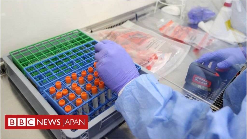 新型コロナウイルスの変異株はどこまでひどくなる？　限界はあるのか - BBCニュース