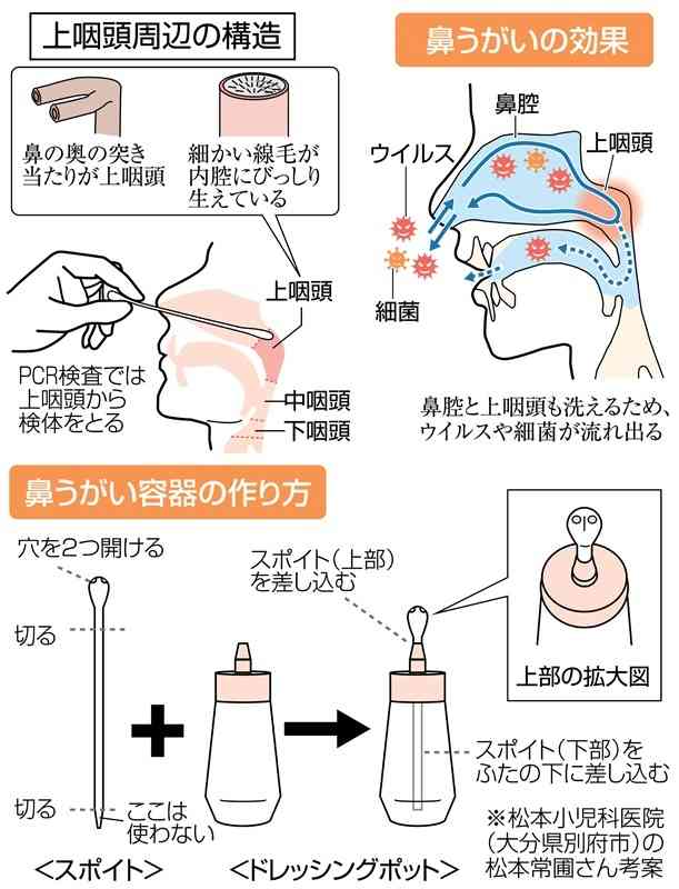 感染対策強化、何をしたらいい?