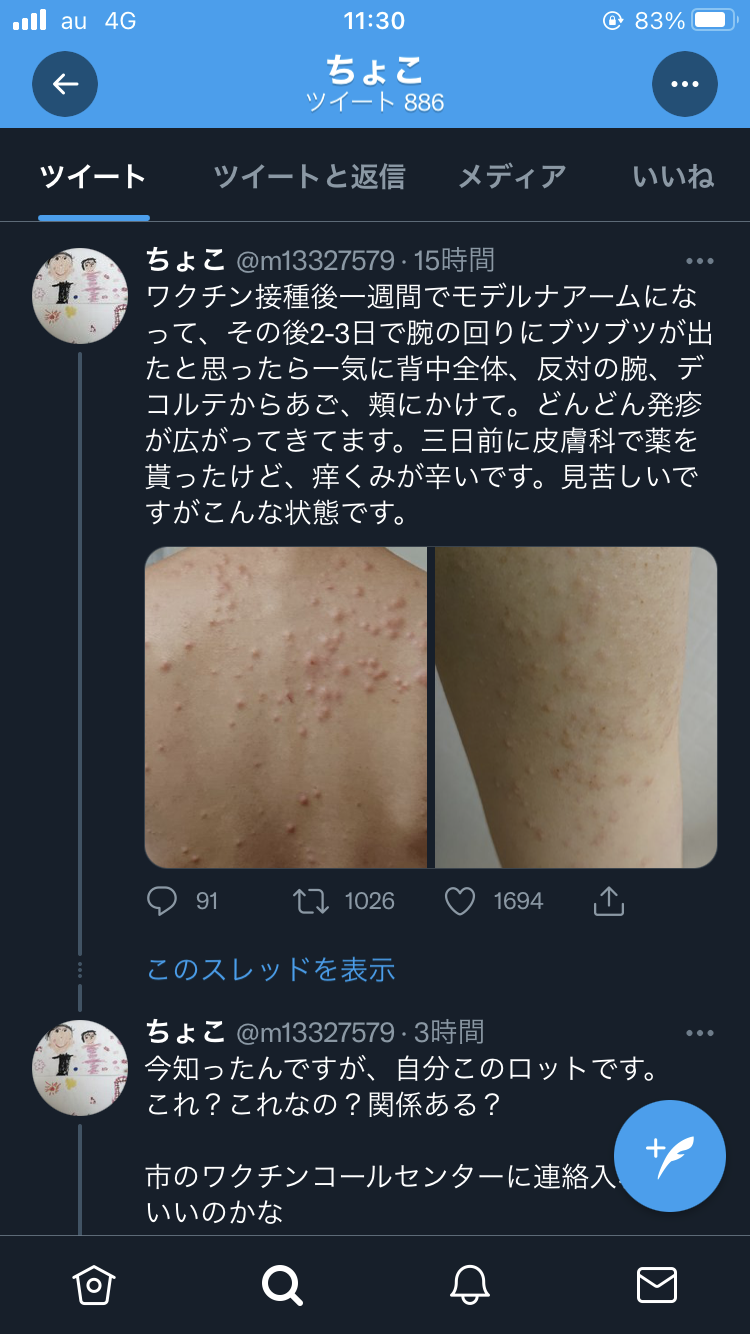 益若つばさ、接種ワクチン異物混入ロットと一致「元気です」もファン心配