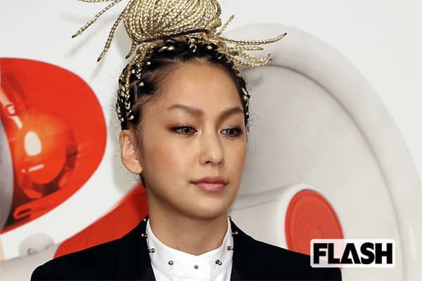 中島美嘉、両側耳管開放症を患って歌も変化「痛みに寄り添う」 | Smart FLASH/スマフラ[光文社週刊誌]