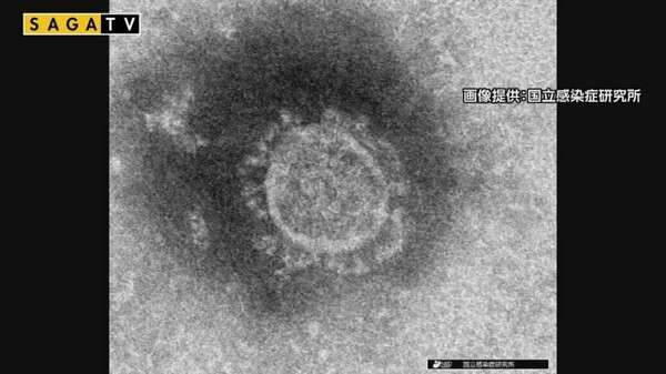３０代に初の死者　佐賀県が発表　基礎疾患なし