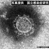 >>48似たような症状の方が２回目を打って、自己免疫疾患になり歩けなくなって入院... | ガールズちゃんねる - Girls Channel -