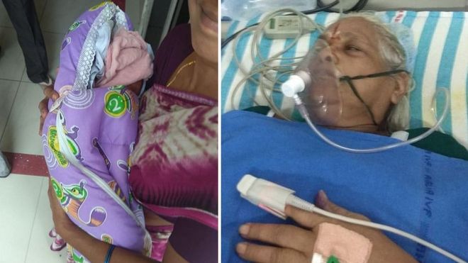 73歳女性が双子を出産　不妊治療経て初産＝インド