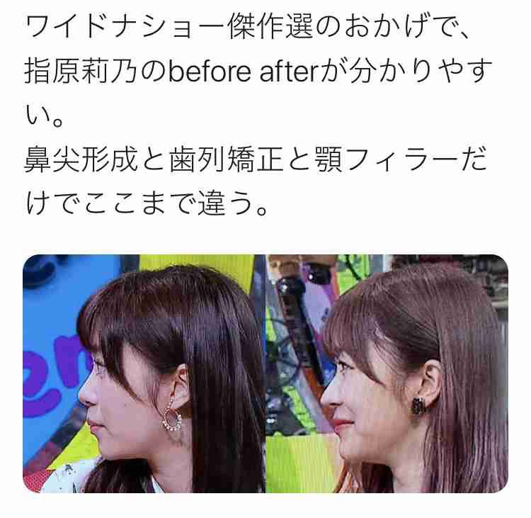 指原莉乃〝理想の体型〟告白でおぎやはぎが悪ノリ「ジャニーズの若いのいこうとしてる」
