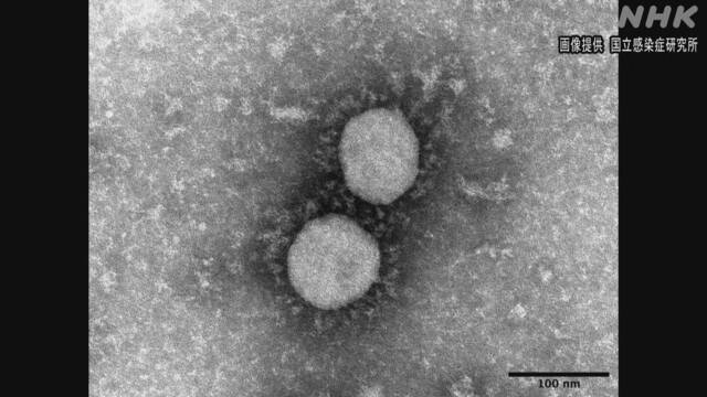 デルタ株 従来のウイルスよりも症状引き起こす力が強い可能性 | 新型コロナウイルス | NHKニュース