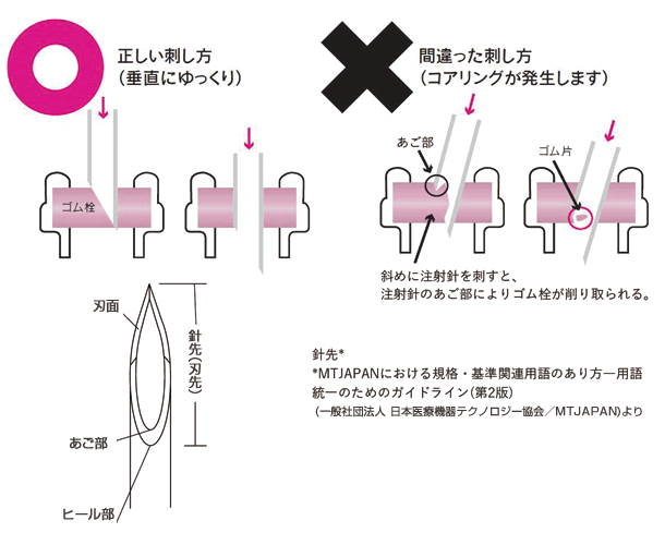 ファイザー製でもワクチンに異物、ゴムの破片か　沖縄