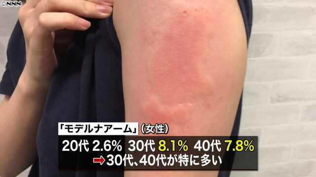 「モデルナアーム」３０・４０代女性に多い（日本テレビ系（NNN）） - Yahoo!ニュース