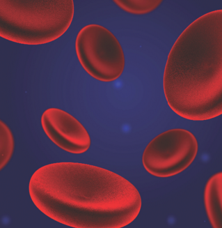 Foot Gangrene From Complication of Heparin-Induced Thrombocytopenia | Consultant360
