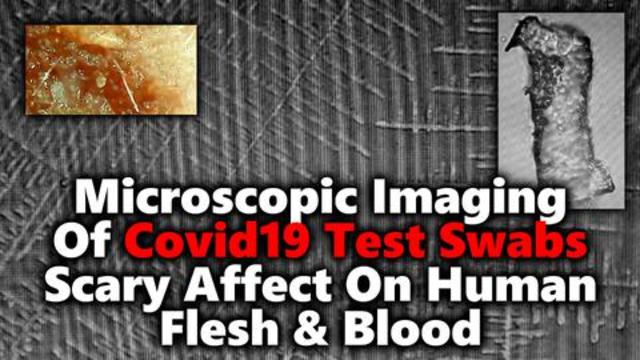 Covid Test Swabs UP CLOSE: New Report Claims Test Fibers Packed Dangerous DARPA Hydrogel & Lithium