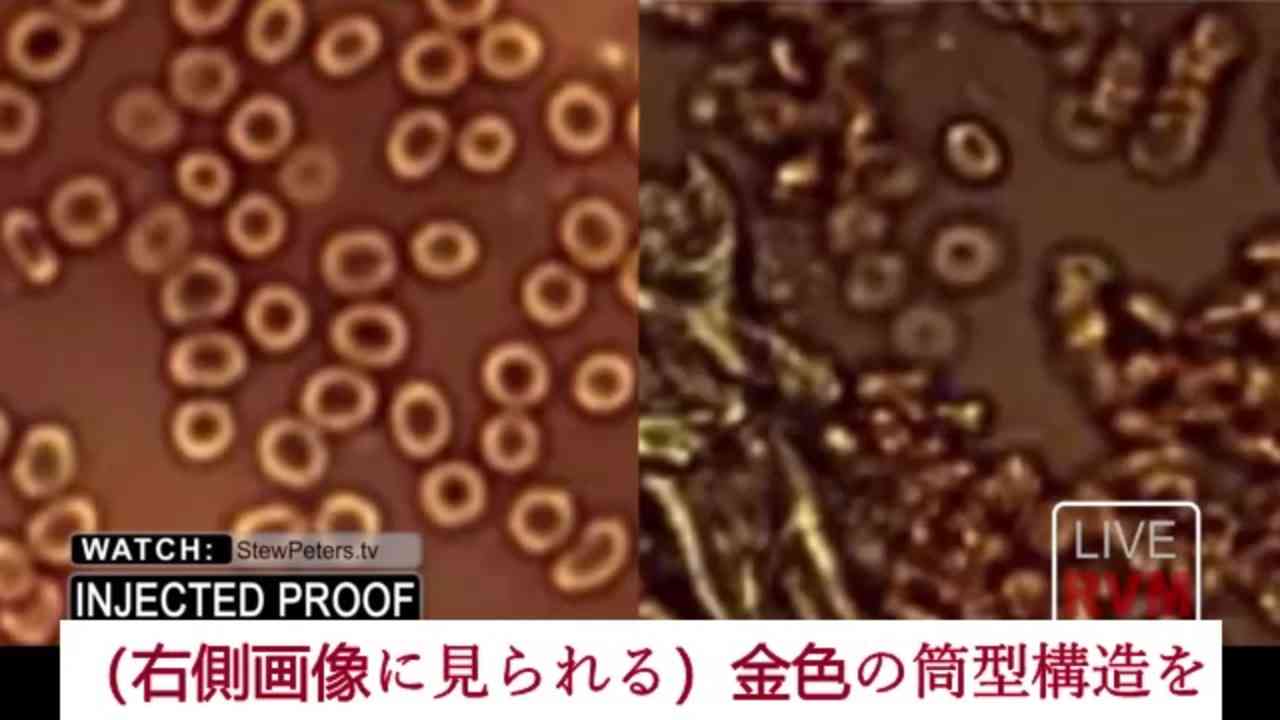 ワクチン接種者の血液に一体何が起こっているのか？！  ジェーン・ルビー医師が、顕微鏡下で見たその血液の衝撃的な映像を伝えます - ニコニコ動画