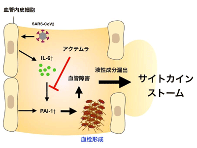新型コロナ 東京都で新たに3058人の感染確認 日曜日として過去最多