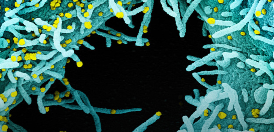 Scanning & Transmission Electron Microscopy Reveals Graphene Oxide in CoV-19 Vaccines