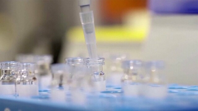 ワクチン2回目接種後にそばアレルギーの男性死亡　回収対象のモデルナ製...因果関係不明（フジテレビ系（FNN）） - Yahoo!ニュース