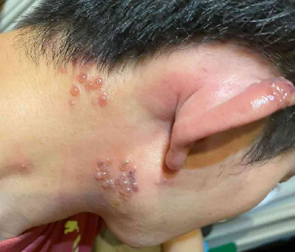 報告は氷山の一角！コロナワクチン接種後の副反応、死亡のツイートが多すぎて戦慄！vol.35 | 泣いて生まれてきたけれど
