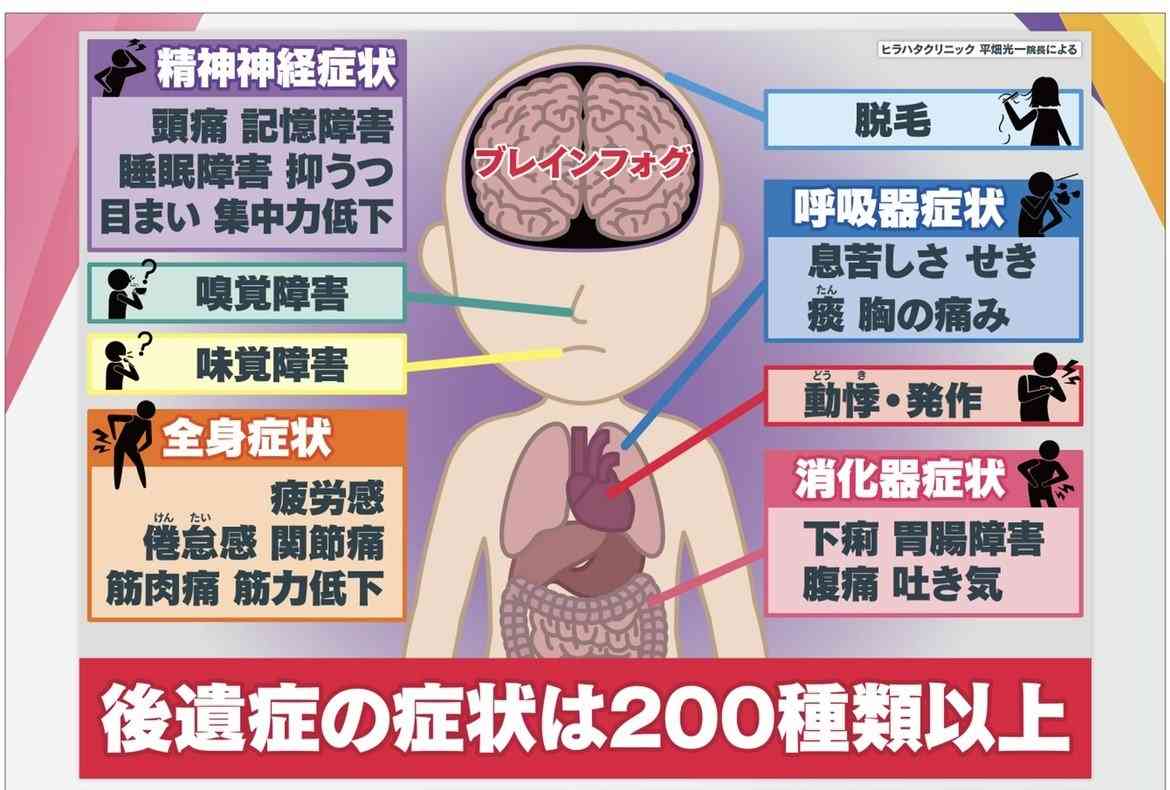 News Digest - ブレインフォグ「脳に霧」 “コロナ後遺症” 感染1年後も頭痛や倦怠感