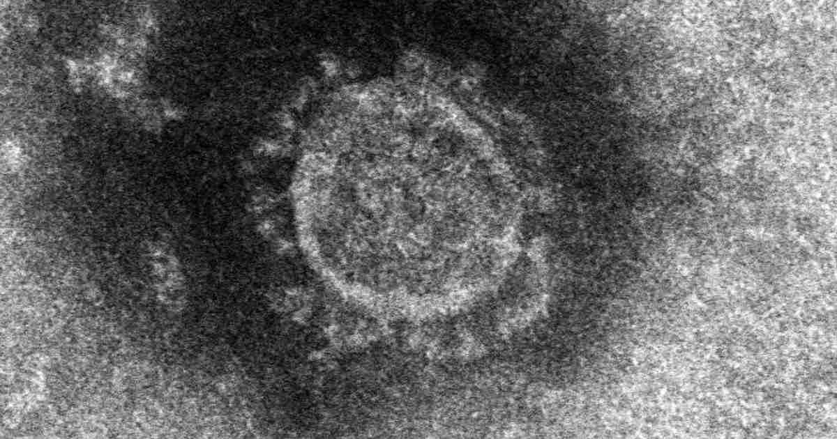 「ミュー株」国内初確認　2空港検疫で　コロンビア由来の変異株 | 毎日新聞